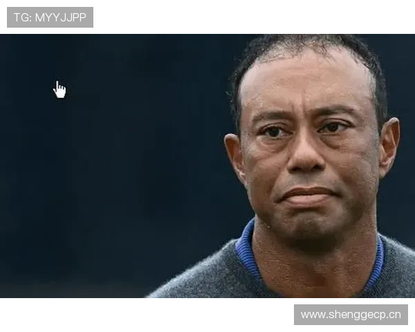 泰格·伍兹连擦杆的手套都比我年薪贵